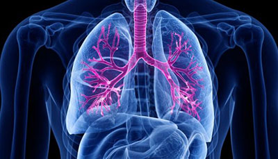 什么是慢性阻塞性肺病 (Chronic Obstructive Pulmonary Disease)，為何與新冠疫情有關(guān)？